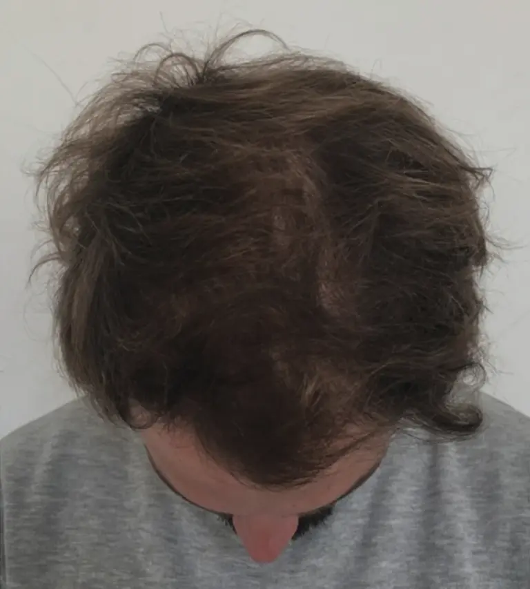 Rectangle 8 (2)