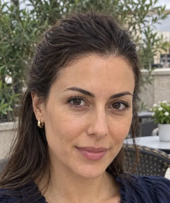 Elena's Hair Transplant after