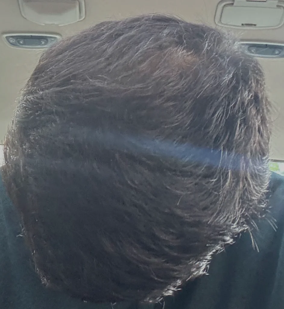 Crown after